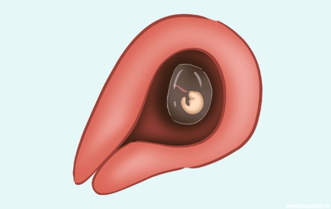 عکس بچه ۴ هفته در شکم مادر