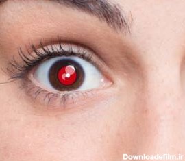 علت قرمزی چشم تو عکس و راه حل آن چیست؟