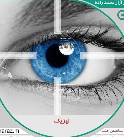 لیزیک صفر تا صد + قیمت عمل لیزیک در تبریز | دکتر محمدزاده