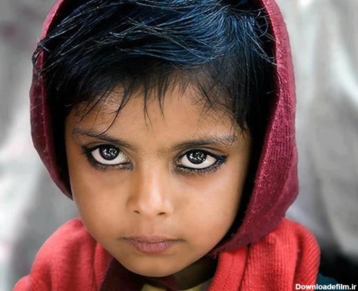 این کودک صاحب زیباترین چشم ها در دنیاست! (عکس)