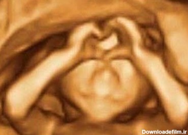 ژست جالب جنین درون شکم مادرش + عکس - تسنیم