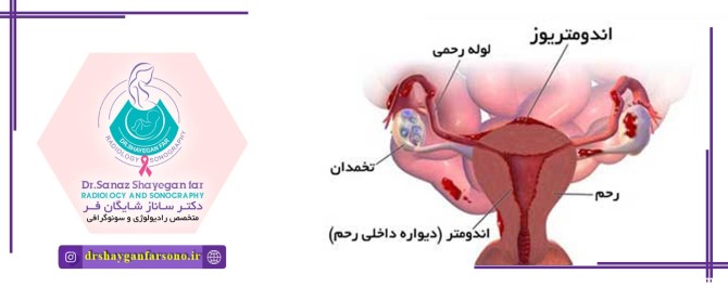 عکس رنگی از رحم در اصفهان