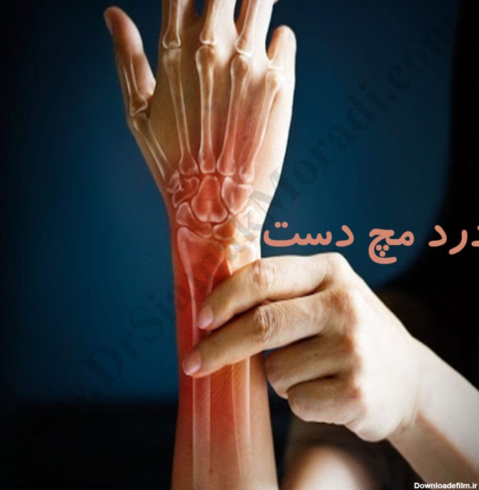 درد مچ دست ، علت و درمان آن - دکتر سیامک مرادی، فوق تخصص درد