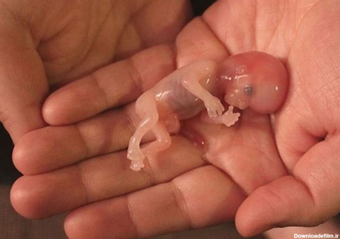عکس جنین سقط شده نه هفته