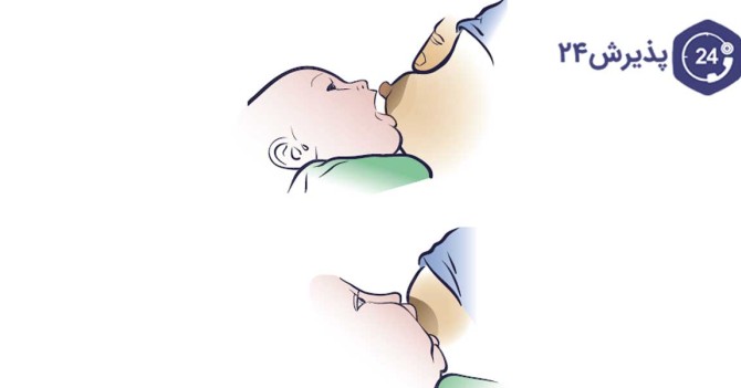 توقف شیردهی به نوزاد