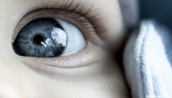 استفاده از لنزهای تماسی آرایشی نیز می‌تواند به طور موقتی رنگ چشم را تغییر دهد اما رنگ چشم ممکن است به طور طبیعی نیز تغییر کند.
