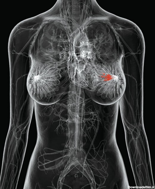ماموگرافی | مرکز تصویربرداری پزشکی آرین