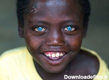 تصاویری از زیباترین کودکان چشم‌رنگی در فضای مجازی