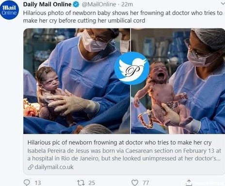 نگاه عجیب نوزاد تازه متولد شده به پزشک سوژه شد! +عکس