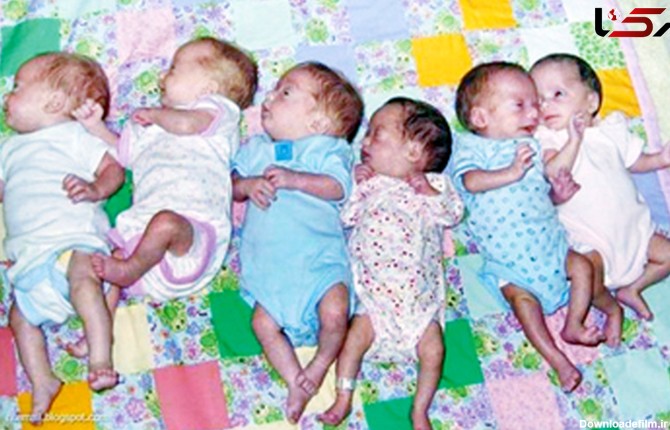 تولد ۱۱ نوزاد در ۲ زایمان + عکس
