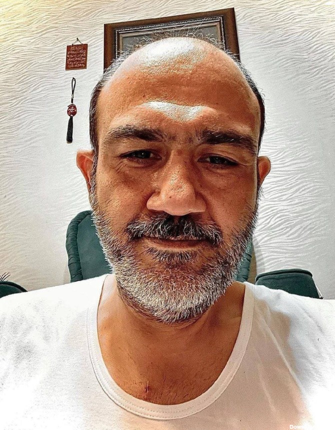 اولین عکس مهران غفوریان بعد از عمل جراحی | روزنو