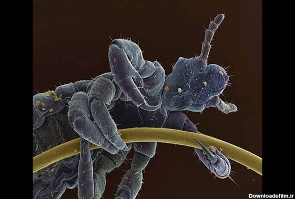 عکسی حیرت انگیز از یک شپش چسبیده به موی انسان زیر میکروسکوپ | طرفداری