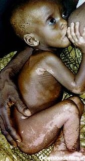 نیازمندان | گالری عکس گرسنگان آفریقا