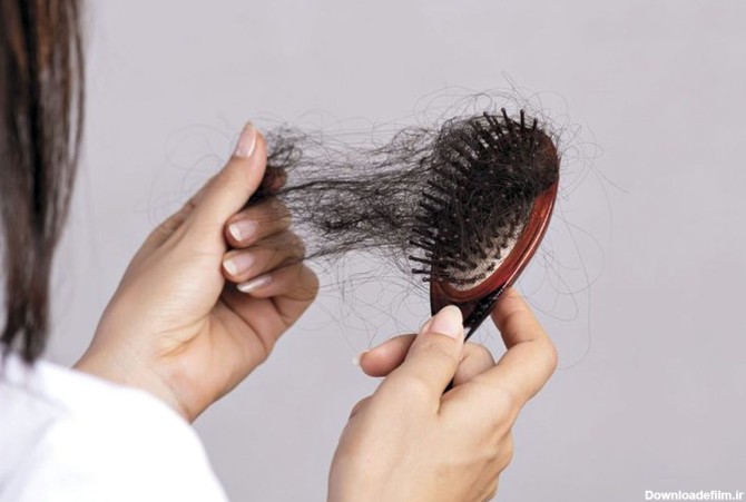 آیا ریزش مو در یائسگی طبیعی است؟ | روزنو