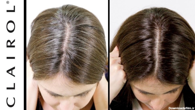 رنگ کردن ریشه مو سفید ، قبل و بعد رنگ کردن ریشه مو ،