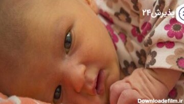 درمان زردی نوزادان با طب سنتی