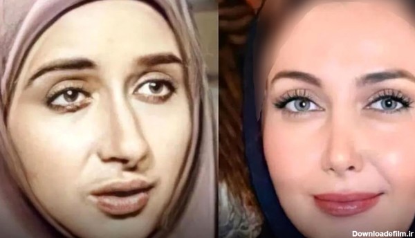 چهره قبل و بعد عمل بازیگران ایرانی ! + اسامی باورنکردنی با چهره های حیرت آور