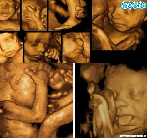 سه ماهه اول بارداری، سونوگرافی های ضروری