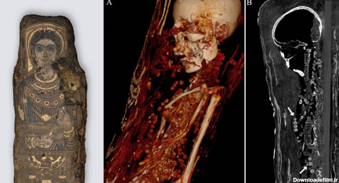 افشای راز مومیایی سلطنتی با تکنیک تصویربرداری پزشکی+تصاویر ...