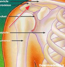 در رفتگی مفصل ترقوه به کتف یا shoulder separation | دکتر علی کوشان