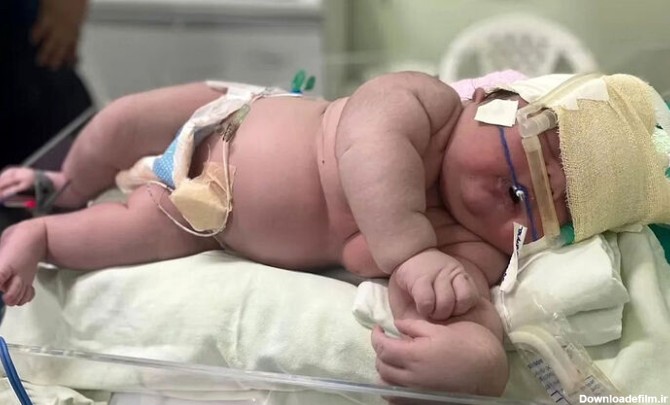 قصور پزشکی جان نوزاد ۱۳ ماهه را در بیمارستان مفید گرفت