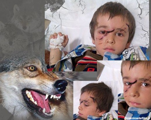 حمله حیوان وحشی به ۱۰نفر دریک روز + عکس - پایگاه خبری تحلیلی یوپنا ...