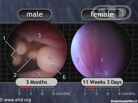 شکل جنین در سه ماهگی
