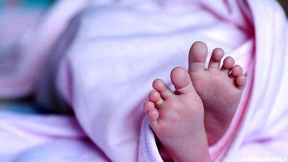 یک نوزاد ترسناک و عجیب الخلقه در شیراز به دنیا آمد!+عکس