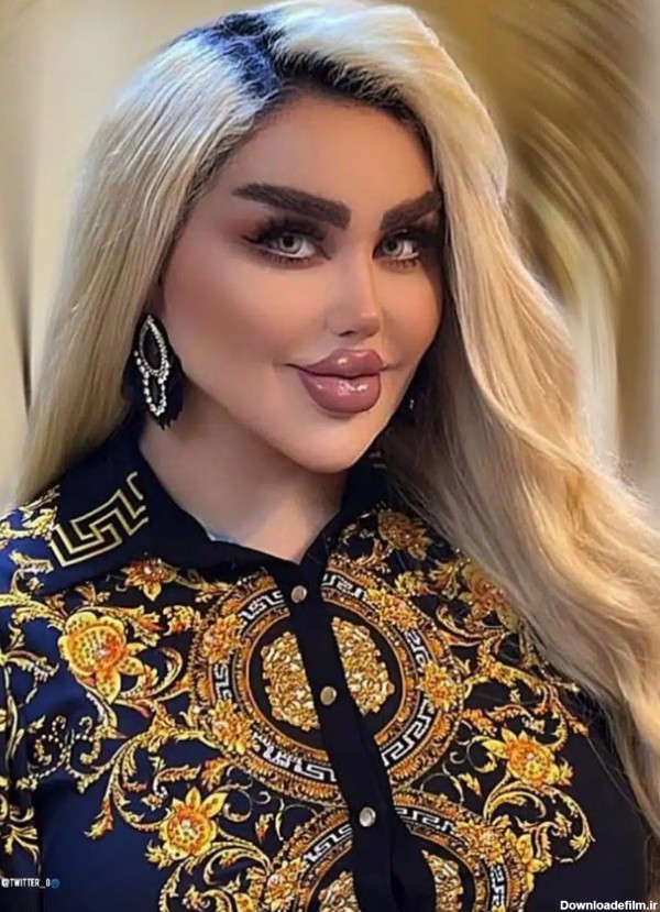 خانم باربی عراقی با ۴۳ عمل زیبایی زامبی شد ! + عکس حیرت انگیز