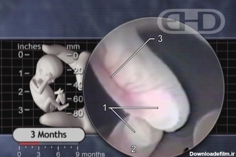 شکل جنین در سه ماهگی