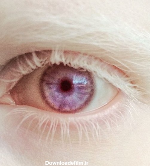 نادرترین رنگ چشم در جهان/ چرا رنگ چشم برخی بنفش است؟ / عکس