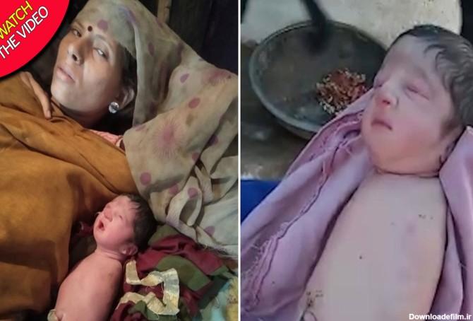 یک نوزاد بدون دست و پا در هند متولد شد+ عکس و فیلم | پایگاه خبری ...