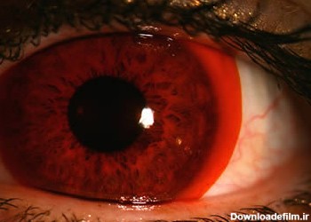 ۱۵ مدل لنز چشم ترسناک و عجیب که تاکنون ندیده‌اید | لنز و عینک لوناتو
