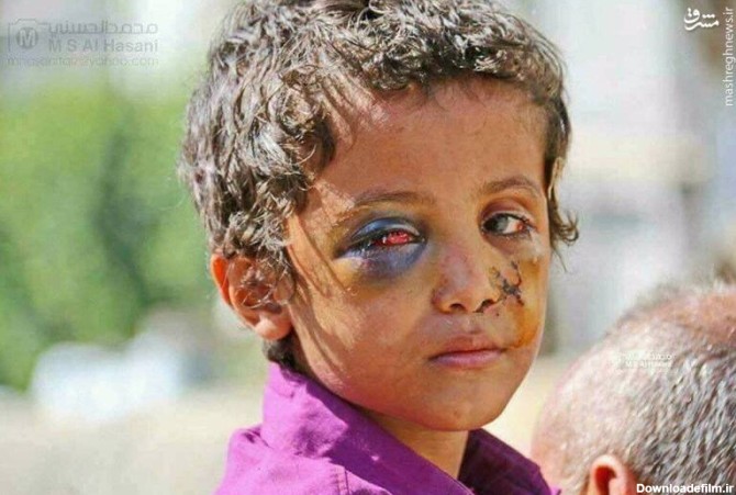 صورت این کودک نه آرایشش هالووینه، نه حتی گریم +عکس - مشرق نیوز