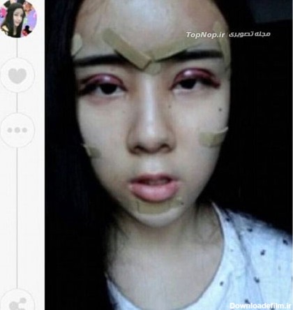 جراحی بحث برانگیز دختر 15 ساله +عکس