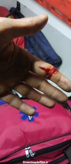 فرارو | (تصاویر) حمله خونین به تکنسین‌های اورژانس تهران با چاقو و قمه