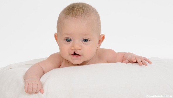 علل ایجاد ناهنجاری‌های مادرزادی در نوزادان-ناهنجاری-بیماری ژنتیکی ...