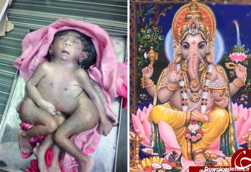 نوزادِ انسان چهارپا، خدای جدید هندی‌‌ها +تصاویر