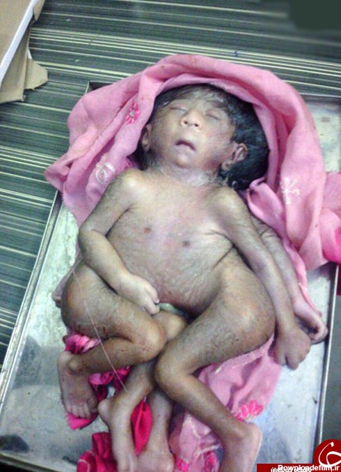نوزادِ انسان چهارپا، خدای جدید هندی‌‌ها +تصاویر
