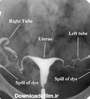 عکس رنگی رحم سالم