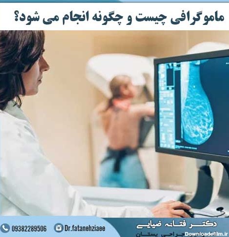 ماموگرافی چگونه انجام میشود | فیلم نحوه انجام ماموگرافی + هزینه ...