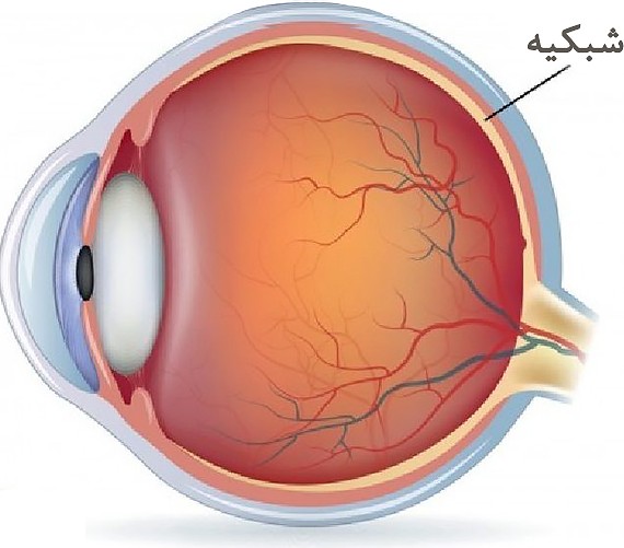Retinal بیماری های شبکیه چشم