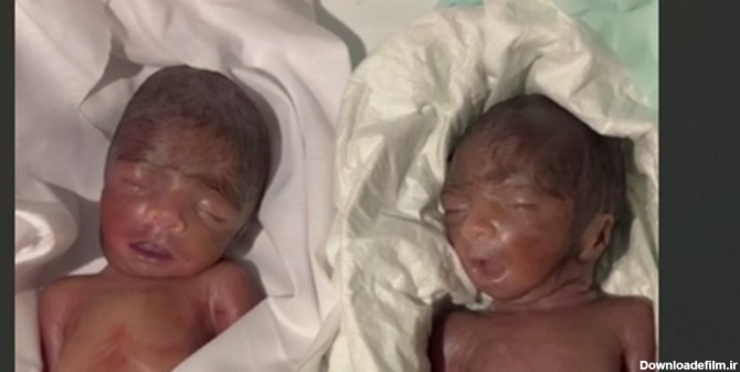 جزئیات علل فوت نوزادان دوقلو در چابهار | خبرگزاری فارس