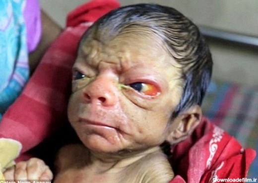 عکس بچه زشت نوزاد