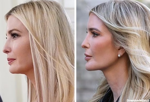 تغییر چهره دختر رئیس‌جمهور سابق آمریکا تعجب برانگیز شد