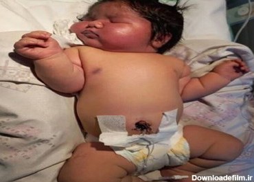سنگین وزن ترین نوزاد در مشهد