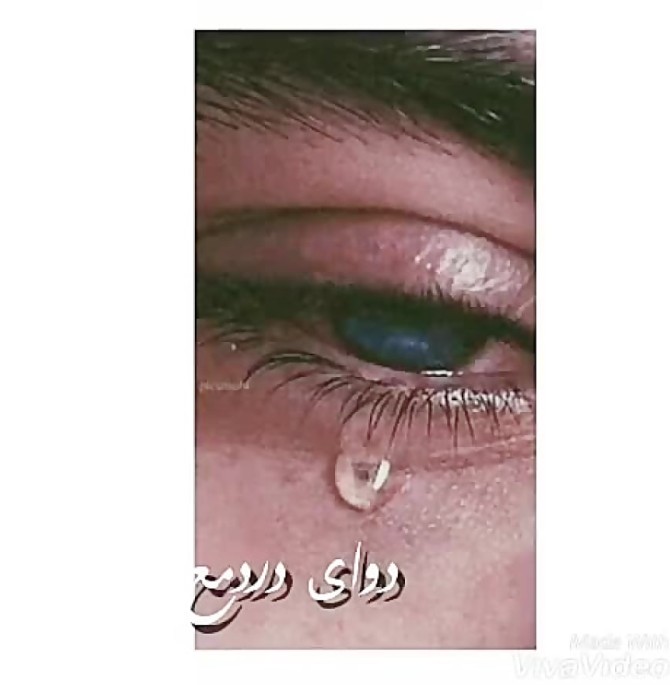 گریه غمگین چشم گریه