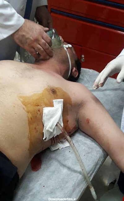 دو شهربان شهرداری با چاقوی قانون شكنان مجروح شدند/شهاب حسینی از ناحیه سینه آسیب دید+عكس