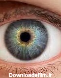 رنگ چشم تیله ای چیست | عکسها و معرفی آن