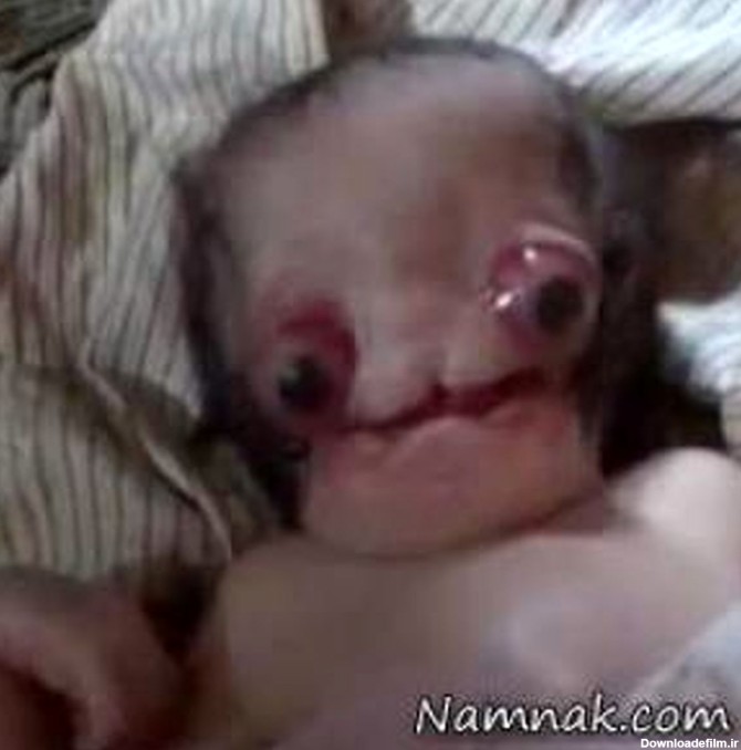 تولد ترسناک ترین نوزاد جهان + فیلم و عکس 18+